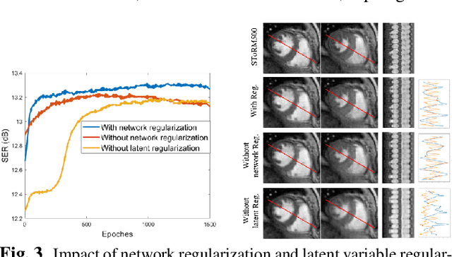 Figure 3 for Deep Generative SToRM model for dynamic imaging
