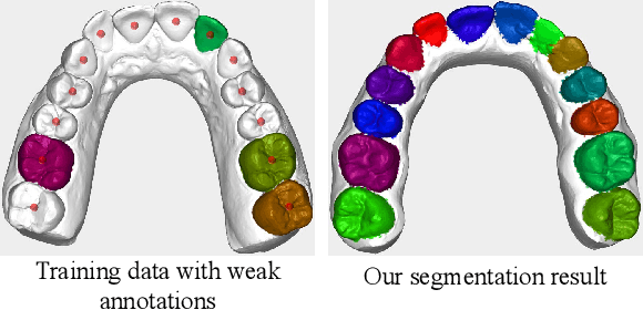 Figure 1 for DArch: Dental Arch Prior-assisted 3D Tooth Instance Segmentation