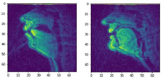 Figure 1 for Reconstructing Speech from Real-Time Articulatory MRI Using Neural Vocoders