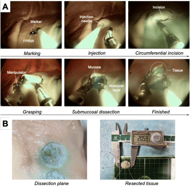 Figure 1 for A Miniature 3-DoF Flexible Parallel Robotic Wrist Using NiTi Wires for Gastrointestinal Endoscopic Surgery