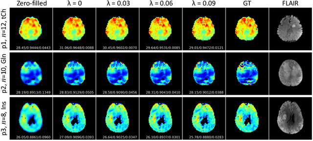 Figure 3 for Multi-scale Super-resolution Magnetic Resonance Spectroscopic Imaging with Adjustable Sharpness