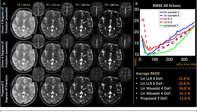 Figure 4 for Latent Signal Models: Learning Compact Representations of Signal Evolution for Improved Time-Resolved, Multi-contrast MRI