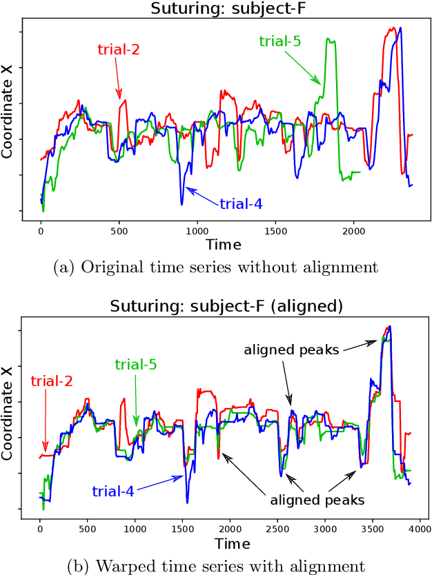 Figure 2 for Automatic alignment of surgical videos using kinematic data