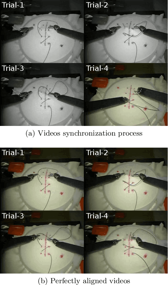 Figure 4 for Automatic alignment of surgical videos using kinematic data