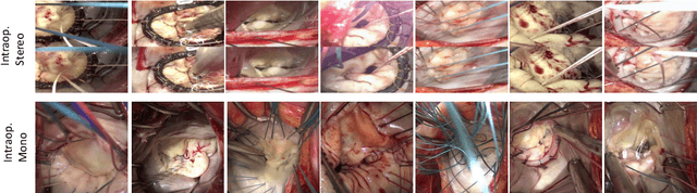 Figure 2 for Cross-Domain Conditional Generative Adversarial Networks for Stereoscopic Hyperrealism in Surgical Training