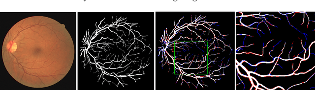 Figure 1 for Deep supervision with additional labels for retinal vessel segmentation task