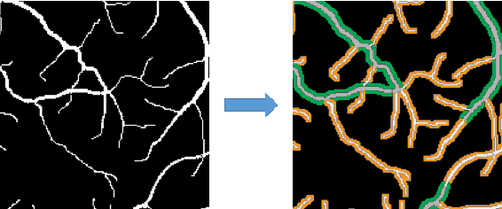 Figure 4 for Deep supervision with additional labels for retinal vessel segmentation task