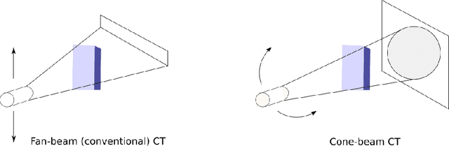 Figure 3 for Exploring constraints on CycleGAN-based CBCT enhancement for adaptive radiotherapy