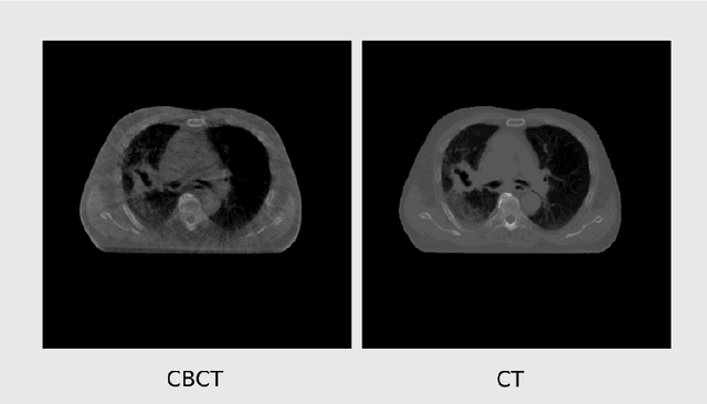 Figure 4 for Exploring constraints on CycleGAN-based CBCT enhancement for adaptive radiotherapy