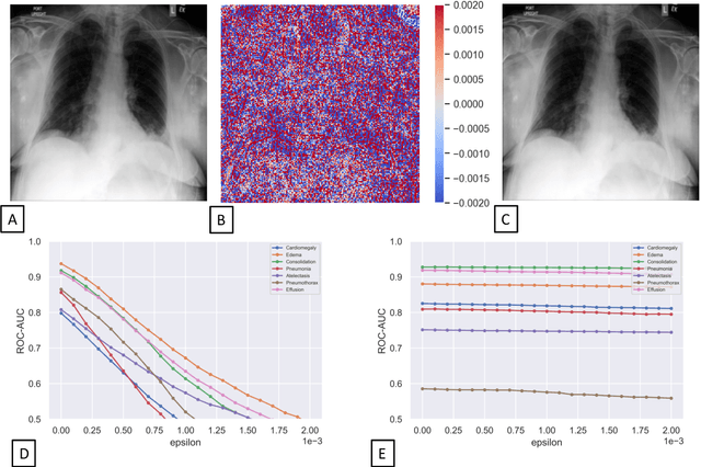 Figure 1 for Advancing diagnostic performance and clinical usability of neural networks via adversarial training and dual batch normalization