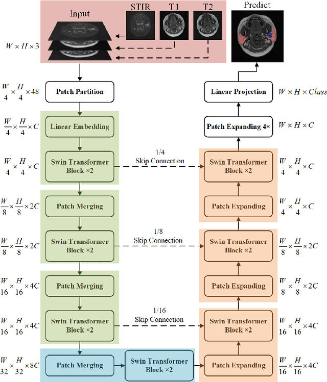 Figure 2 for Parotid Gland MRI Segmentation Based on Swin-Unet and Multimodal Images