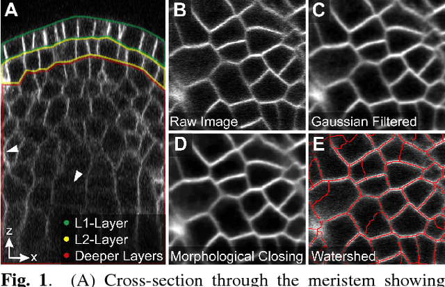 Figure 1 for Cell Segmentation in 3D Confocal Images using Supervoxel Merge-Forests with CNN-based Hypothesis Selection