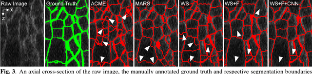 Figure 4 for Cell Segmentation in 3D Confocal Images using Supervoxel Merge-Forests with CNN-based Hypothesis Selection