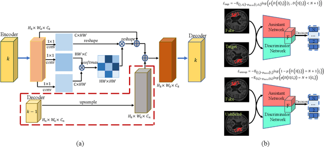 Figure 1 for Brain Stroke Lesion Segmentation Using Consistent Perception Generative Adversarial Network