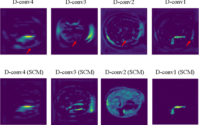 Figure 3 for Brain Stroke Lesion Segmentation Using Consistent Perception Generative Adversarial Network