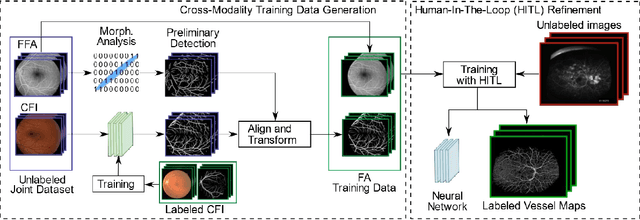 Figure 3 for A Novel Deep Learning Pipeline for Retinal Vessel Detection in Fluorescein Angiography
