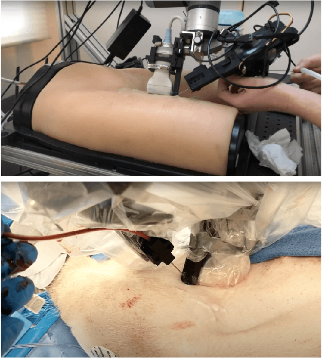 Figure 1 for Toward Robotically Automated Femoral Vascular Access