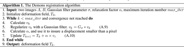 Figure 2 for Non-rigid Registration Method between 3D CT Liver Data and 2D Ultrasonic Images based on Demons Model