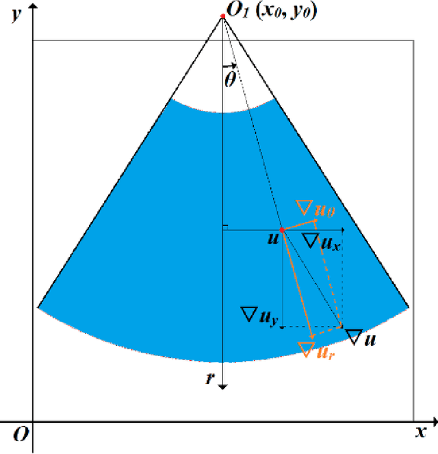 Figure 3 for Non-rigid Registration Method between 3D CT Liver Data and 2D Ultrasonic Images based on Demons Model