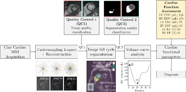 Figure 1 for Quality-aware Cine Cardiac MRI Reconstruction and Analysis from Undersampled k-space Data