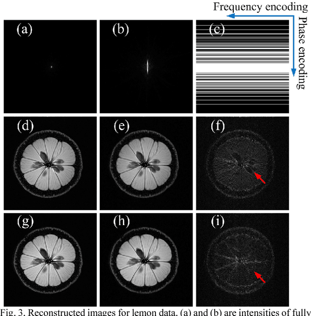 Figure 2 for Spread spectrum compressed sensing MRI using chirp radio frequency pulses