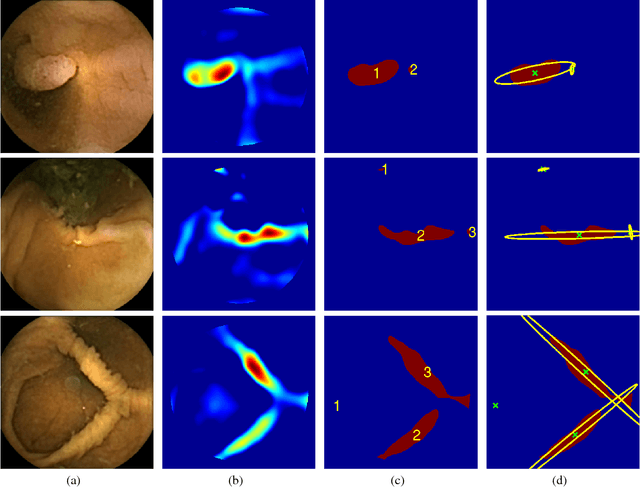 Figure 3 for Automated polyp detection in colon capsule endoscopy