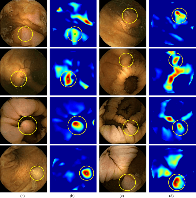 Figure 4 for Automated polyp detection in colon capsule endoscopy