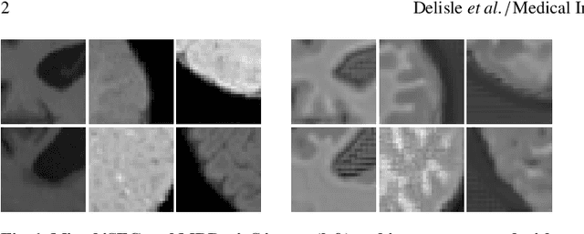 Figure 1 for Realistic Image Normalization for Multi-Domain Segmentation