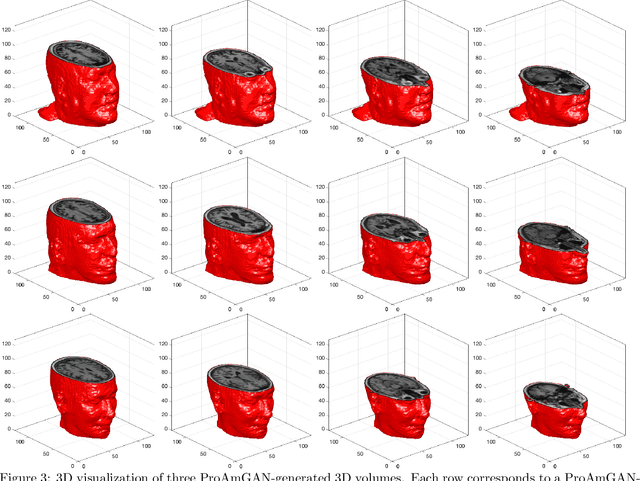 Figure 4 for Advancing the AmbientGAN for learning stochastic object models