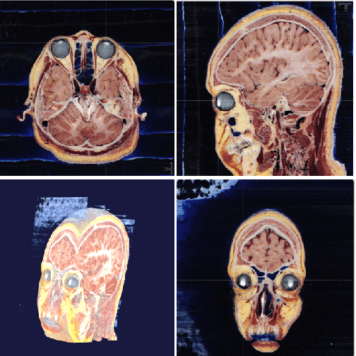 Figure 3 for Comparison of the Deep-Learning-Based Automated Segmentation Methods for the Head Sectioned Images of the Virtual Korean Human Project