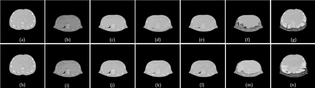 Figure 3 for Generating Patient-like Phantoms Using Fully Unsupervised Deformable Image Registration with Convolutional Neural Networks