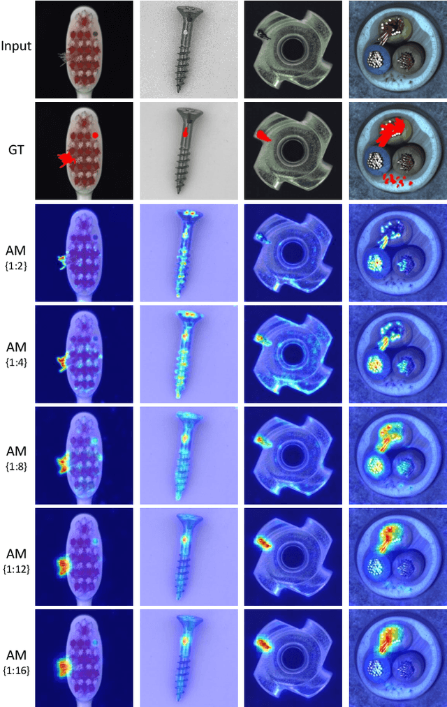 Figure 1 for DFR: Deep Feature Reconstruction for Unsupervised Anomaly Segmentation