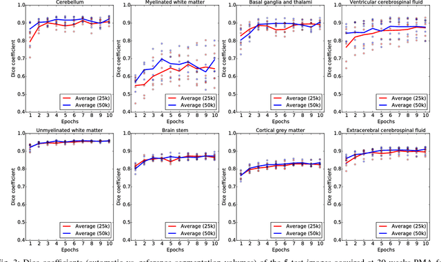 Figure 3 for Automatic segmentation of MR brain images with a convolutional neural network