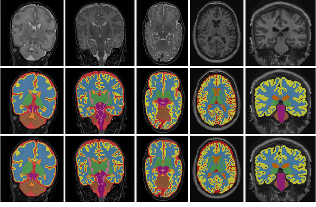 Figure 4 for Automatic segmentation of MR brain images with a convolutional neural network