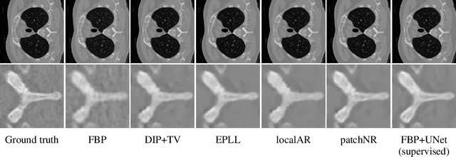 Figure 3 for PatchNR: Learning from Small Data by Patch Normalizing Flow Regularization