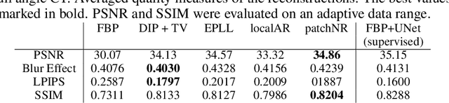 Figure 4 for PatchNR: Learning from Small Data by Patch Normalizing Flow Regularization