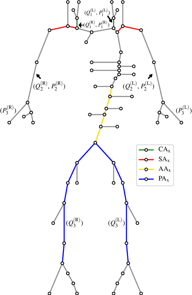 Figure 1 for Machine learning for detection of stenoses and aneurysms: application in a physiologically realistic virtual patient database