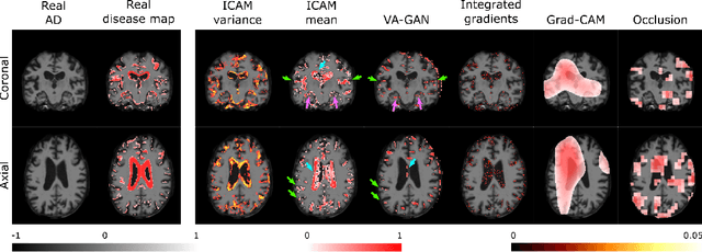 Figure 1 for ICAM: Interpretable Classification via Disentangled Representations and Feature Attribution Mapping