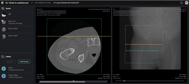 Figure 2 for Deep Learning Body Region Classification of MRI and CT examinations