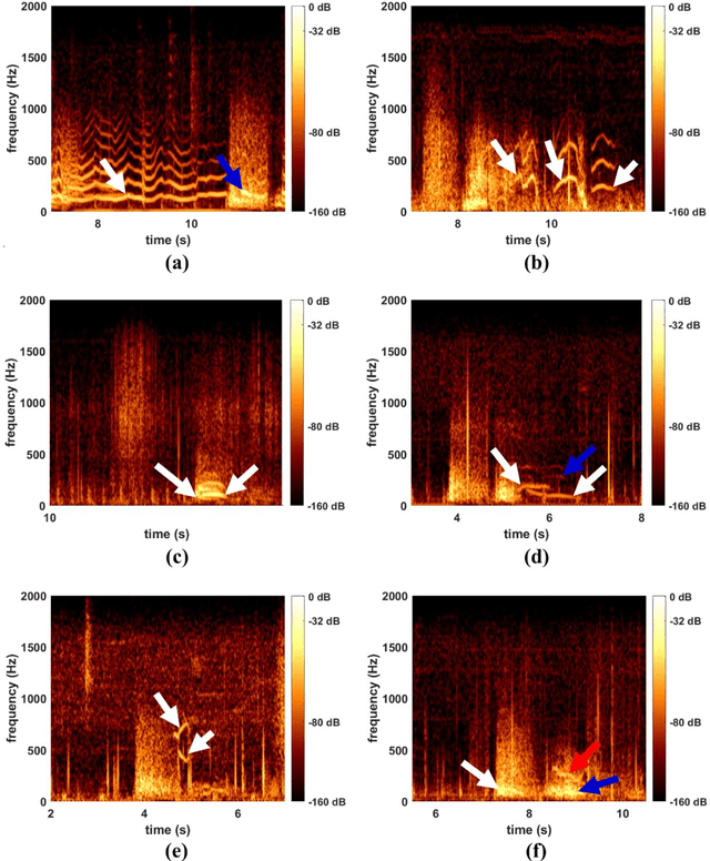Figure 1 for Multi-path Convolutional Neural Networks Efficiently Improve Feature Extraction in Continuous Adventitious Lung Sound Detection