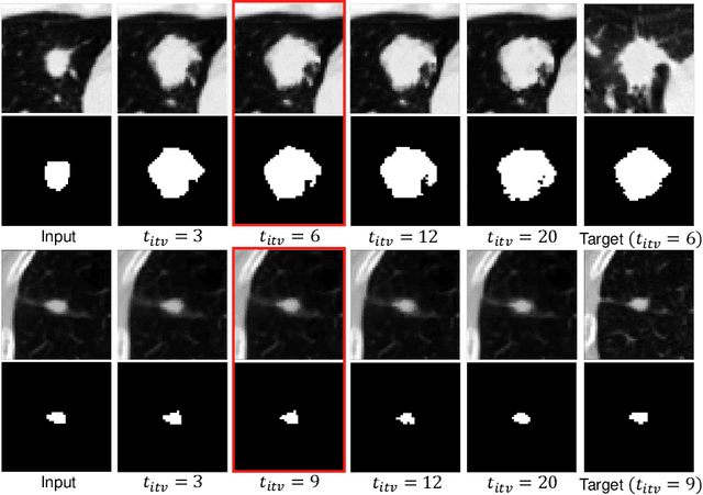 Figure 4 for Malignancy-Aware Follow-Up Volume Prediction for Lung Nodules