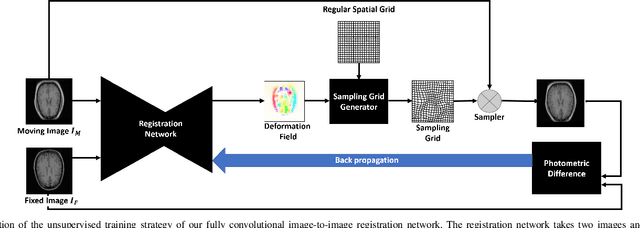 Figure 3 for Unsupervised End-to-end Learning for Deformable Medical Image Registration