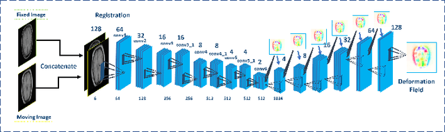 Figure 4 for Unsupervised End-to-end Learning for Deformable Medical Image Registration