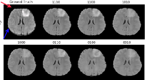 Figure 4 for Missing MRI Pulse Sequence Synthesis using Multi-Modal Generative Adversarial Network