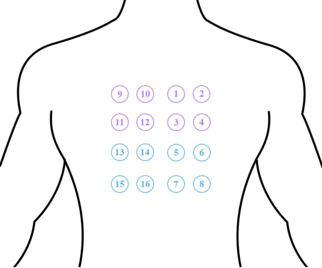 Figure 1 for A Combined Model for Noise Reduction of Lung Sound Signals Based on Empirical Mode Decomposition and Artificial Neural Network
