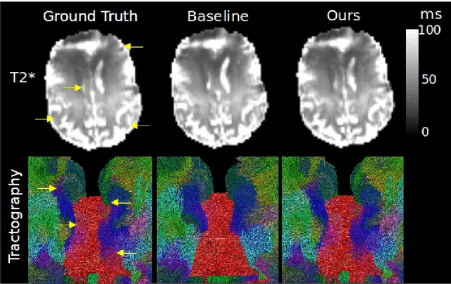 Figure 3 for Progressive Subsampling for Oversampled Data -- Application to Quantitative MRI