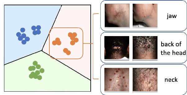 Figure 3 for Sub-cluster-aware Network for Few-shot Skin Disease Classification