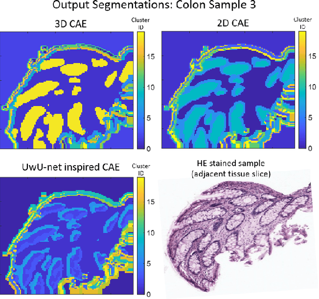 Figure 2 for Unsupervised segmentation of biomedical hyperspectral image data: tackling high dimensionality with convolutional autoencoders