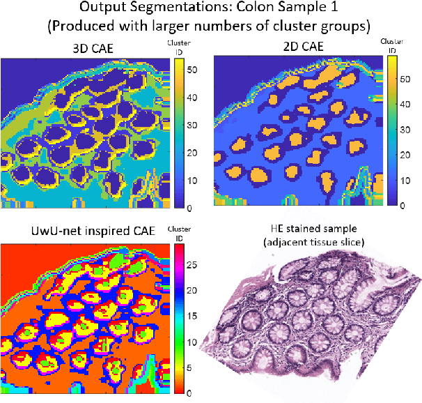 Figure 3 for Unsupervised segmentation of biomedical hyperspectral image data: tackling high dimensionality with convolutional autoencoders