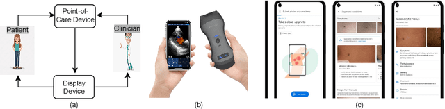Figure 1 for UNeXt: MLP-based Rapid Medical Image Segmentation Network